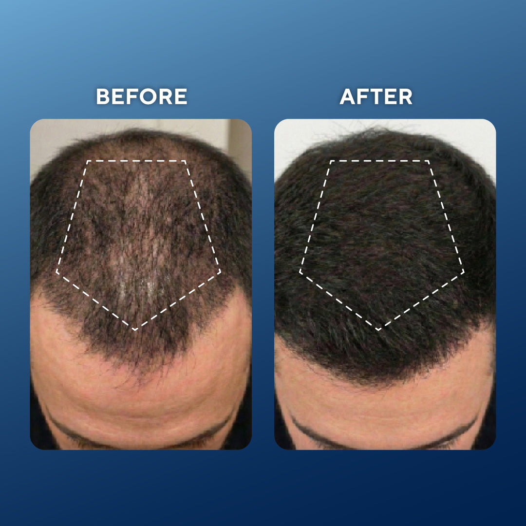 Fortschrittliche Kupferpeptid-Formel für Haarwachstum